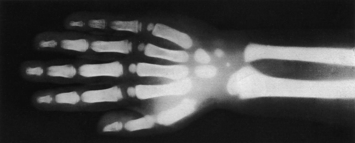 X-Ray Hand